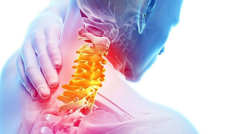 Dor na columna cervical